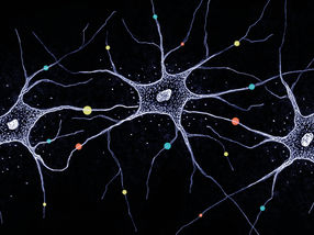 Diversity in the brain
