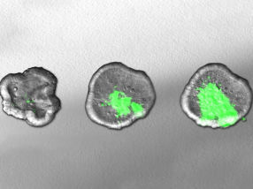 Cultured mini-organs reveal the weapons of aggressive bacteria
